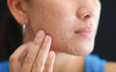 Produk Untuk Kulit Kering, Cari Mana-mana 13 Bahan Ini