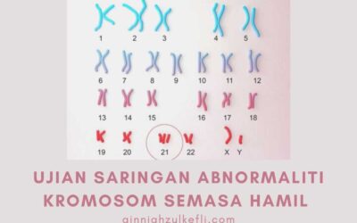 Ujian Saringan Abnormaliti Kromosom
